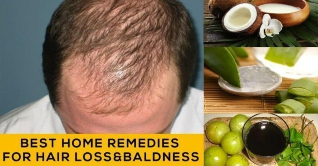 Summer Hair Protection Tips: 15 Secrets Stylists Hide